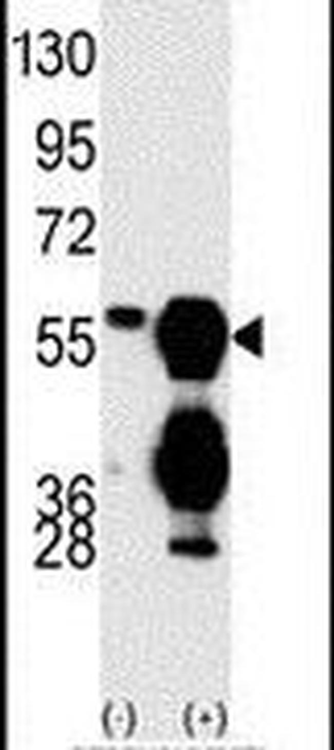 PPM1F Antibody in Western Blot (WB)