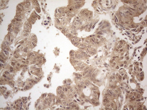 PPP1CA Antibody in Immunohistochemistry (Paraffin) (IHC (P))