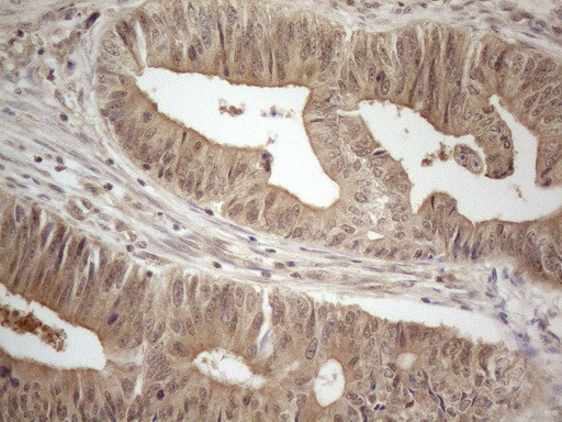 PPP1CA Antibody in Immunohistochemistry (Paraffin) (IHC (P))