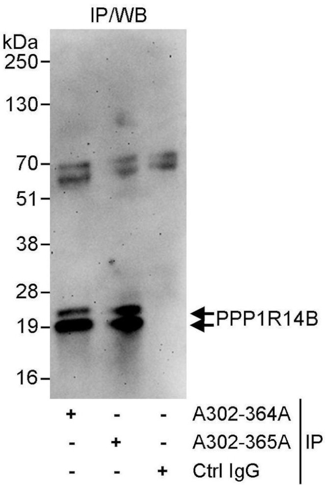 PPP1R14B Antibody in Immunoprecipitation (IP)