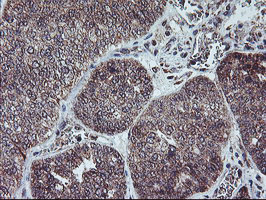 PPP1R15A Antibody in Immunohistochemistry (Paraffin) (IHC (P))