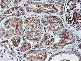 PPP1R15A Antibody in Immunohistochemistry (Paraffin) (IHC (P))