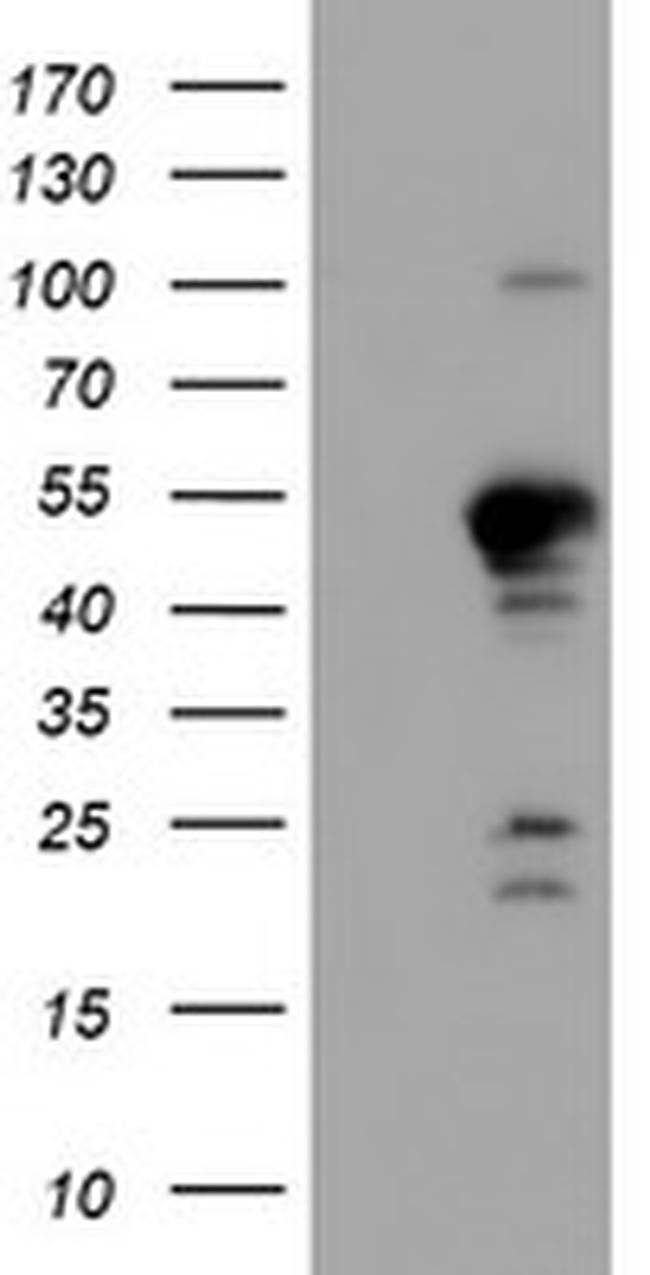 PPP1R15A Antibody in Western Blot (WB)