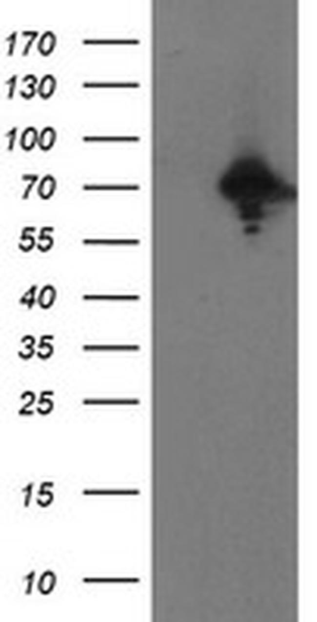 PPP1R15A Antibody in Western Blot (WB)