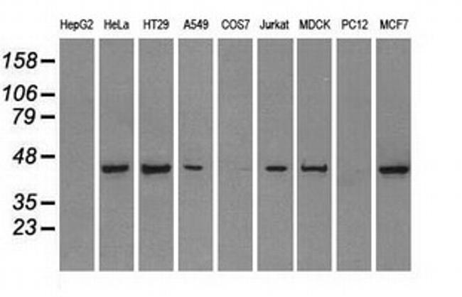 PPP1R7 Antibody in Western Blot (WB)