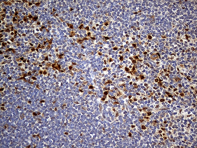 PPP2R1B Antibody in Immunohistochemistry (Paraffin) (IHC (P))