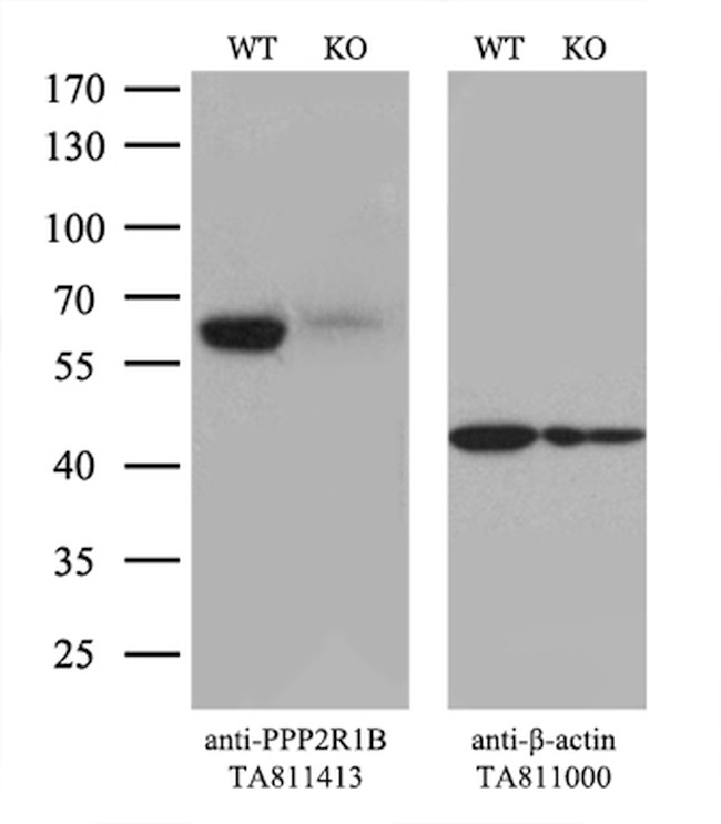 PPP2R1B Antibody