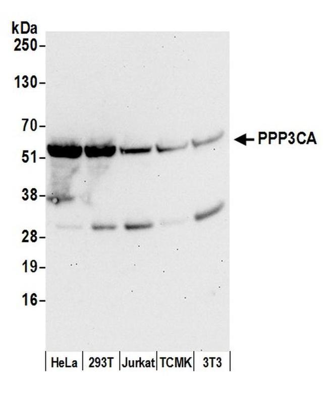 PPP3CA Antibody in Western Blot (WB)