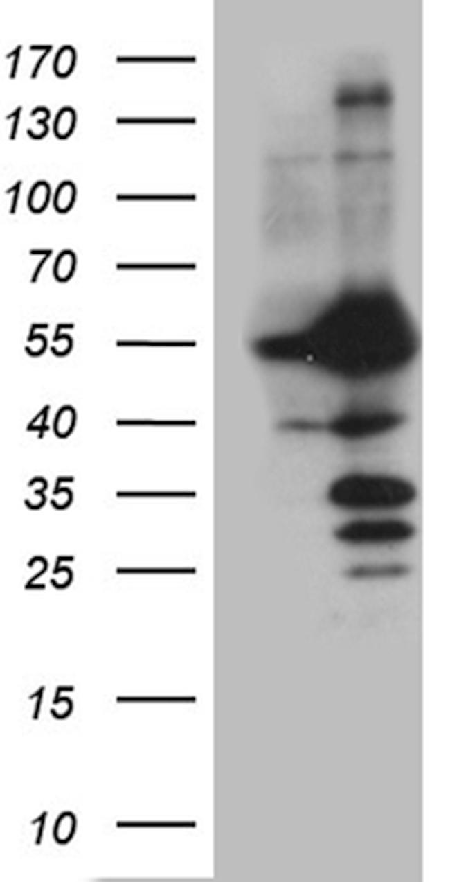 PPP3CB Antibody in Western Blot (WB)