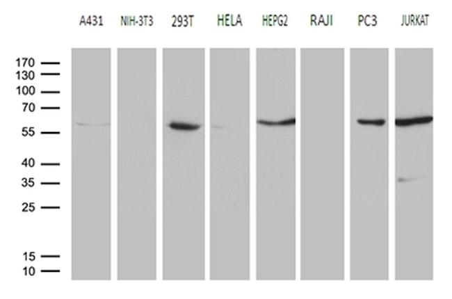 PPP3CB Antibody in Western Blot (WB)