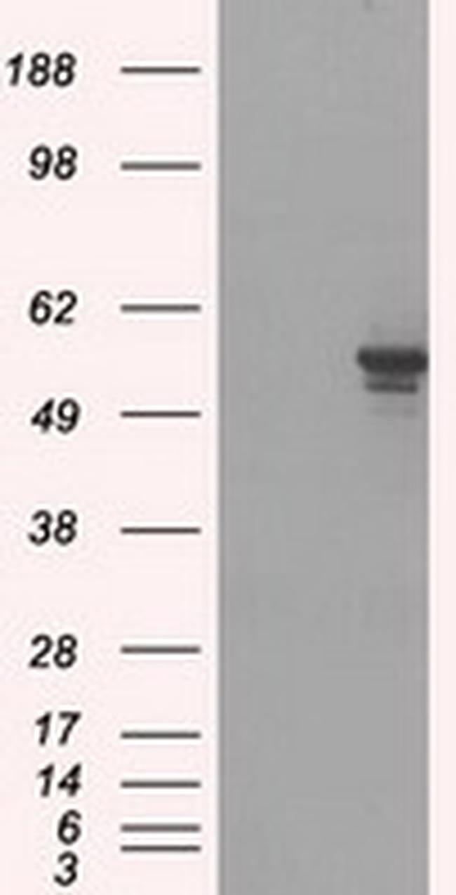 PPP5C Antibody in Western Blot (WB)