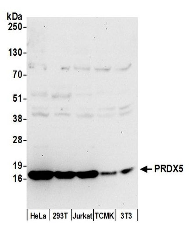 PRDX5 Antibody in Western Blot (WB)