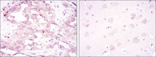 AMPK alpha-1 Antibody in Immunohistochemistry (Paraffin) (IHC (P))