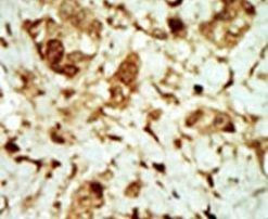 AMPK gamma-3 Antibody in Immunohistochemistry (IHC)