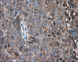 PRKAR2A Antibody in Immunohistochemistry (Paraffin) (IHC (P))