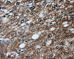 PRKAR2A Antibody in Immunohistochemistry (Paraffin) (IHC (P))