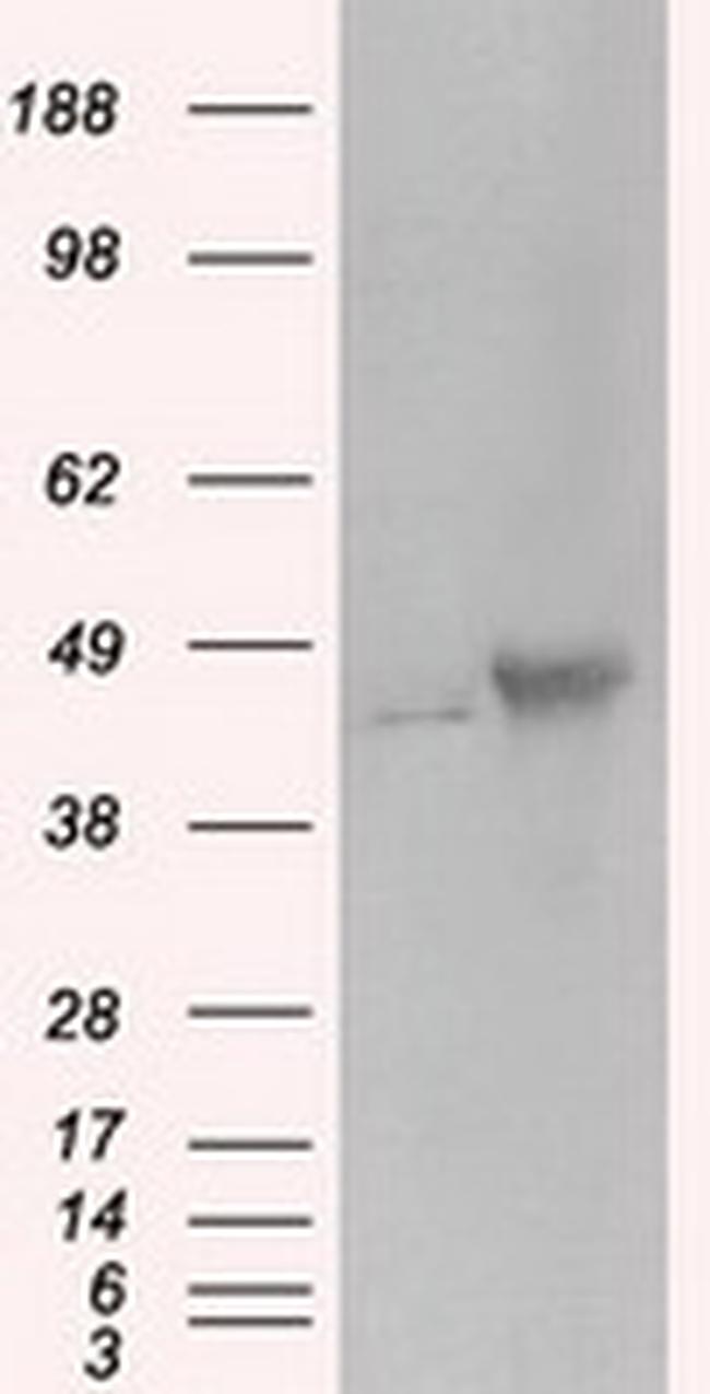 PRKAR2A Antibody in Western Blot (WB)