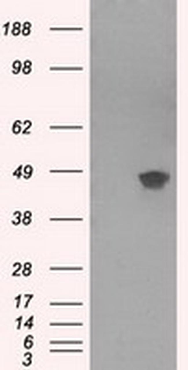 PRKAR2A Antibody in Western Blot (WB)