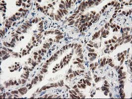 PRKCE Antibody in Immunohistochemistry (Paraffin) (IHC (P))