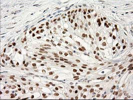 PRKCE Antibody in Immunohistochemistry (Paraffin) (IHC (P))