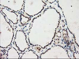 PRKCE Antibody in Immunohistochemistry (Paraffin) (IHC (P))