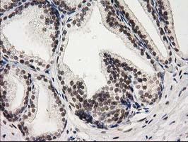 PRKCE Antibody in Immunohistochemistry (Paraffin) (IHC (P))