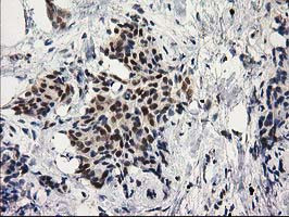 PRKCE Antibody in Immunohistochemistry (Paraffin) (IHC (P))