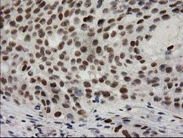 PRKCE Antibody in Immunohistochemistry (Paraffin) (IHC (P))