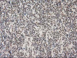 PRKCE Antibody in Immunohistochemistry (Paraffin) (IHC (P))