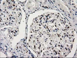 PRKCE Antibody in Immunohistochemistry (Paraffin) (IHC (P))