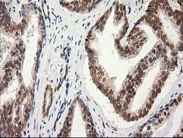 PRKCE Antibody in Immunohistochemistry (Paraffin) (IHC (P))