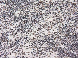 PRKCE Antibody in Immunohistochemistry (Paraffin) (IHC (P))