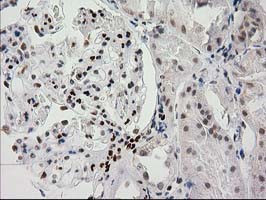 PRKCE Antibody in Immunohistochemistry (Paraffin) (IHC (P))