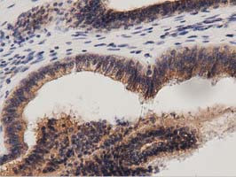 PRKD2 Antibody in Immunohistochemistry (Paraffin) (IHC (P))