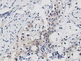 PRKD2 Antibody in Immunohistochemistry (Paraffin) (IHC (P))