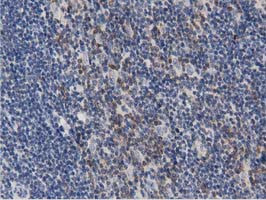 PRKD2 Antibody in Immunohistochemistry (Paraffin) (IHC (P))