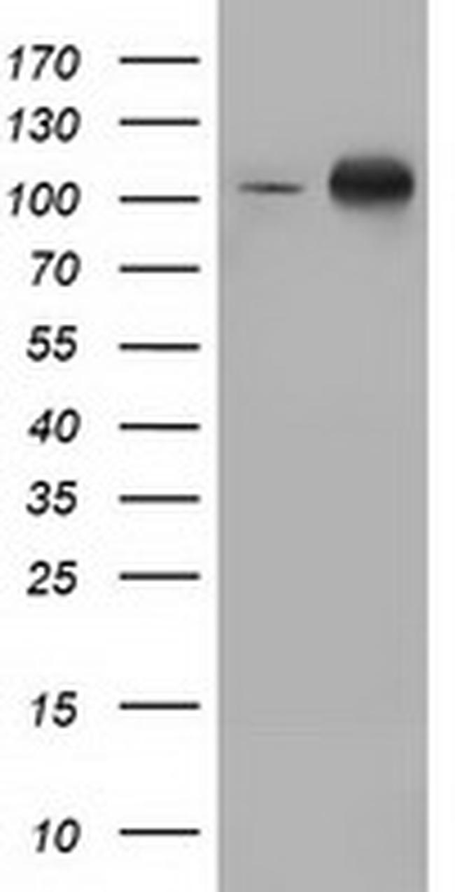 PRKD2 Antibody in Western Blot (WB)