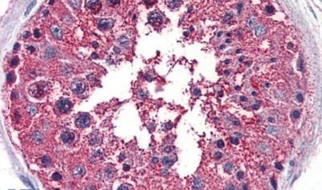 PRKD3 Antibody in Immunohistochemistry (Paraffin) (IHC (P))