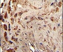 PACT Antibody in Immunohistochemistry (IHC)