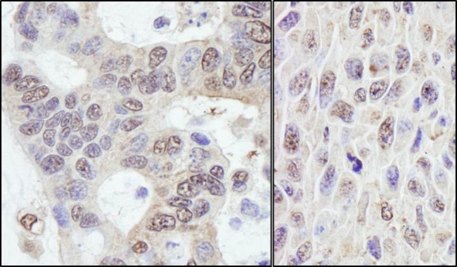 PRKRIR Antibody in Immunohistochemistry (IHC)