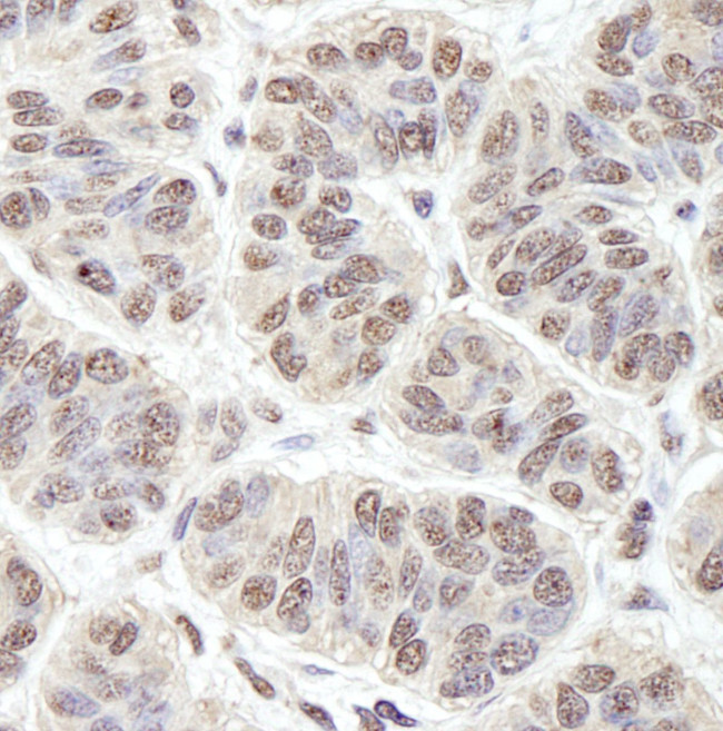 PRKRIR Antibody in Immunohistochemistry (IHC)