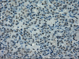 PRKY Antibody in Immunohistochemistry (Paraffin) (IHC (P))