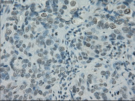 PRKY Antibody in Immunohistochemistry (Paraffin) (IHC (P))