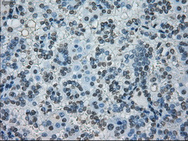 PRKY Antibody in Immunohistochemistry (Paraffin) (IHC (P))