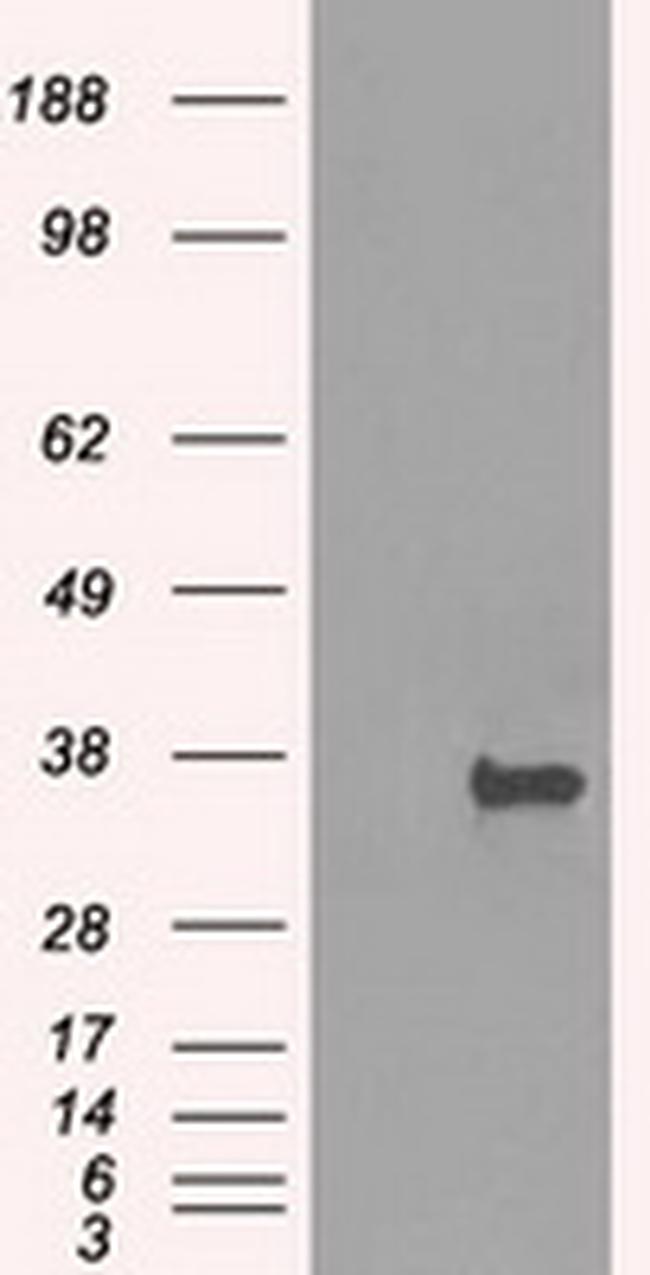 PRKY Antibody in Western Blot (WB)