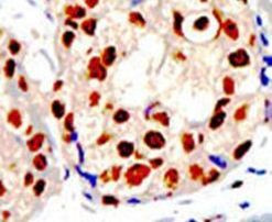 PRMT1 Antibody in Immunohistochemistry (IHC)