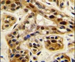 PRMT1 Antibody in Immunohistochemistry (IHC)