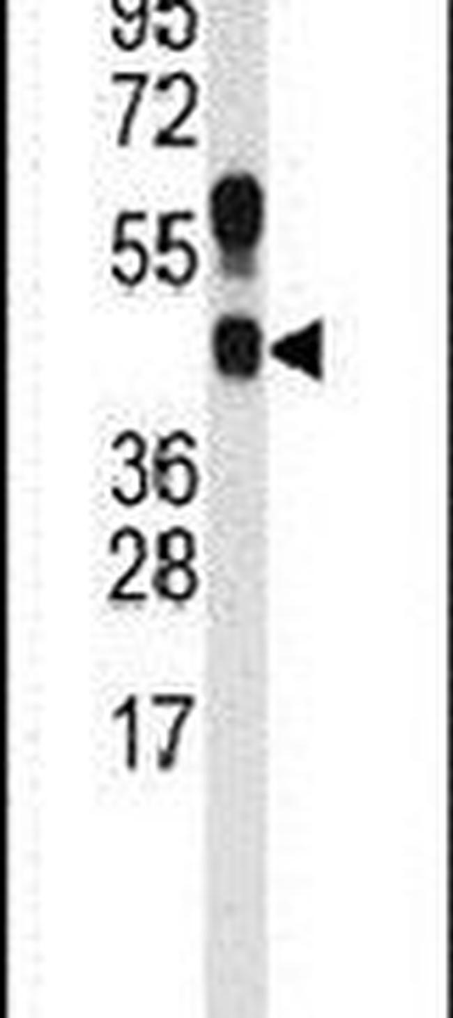 PRMT1 Antibody in Western Blot (WB)