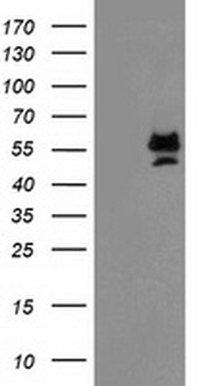 PRMT2 Antibody in Western Blot (WB)