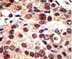 PRMT3 Antibody in Immunohistochemistry (IHC)